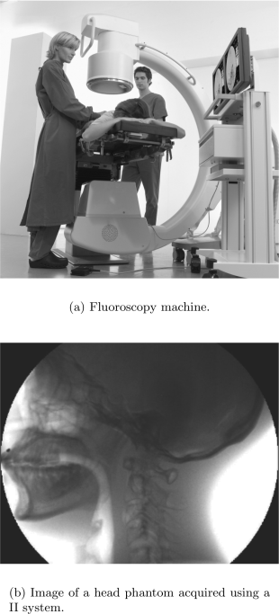 Figure showing Fluoroscopy machine. Original image reprinted with permission from Siemens AG.