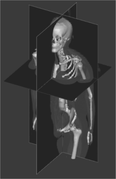 Figure showing 3D object created using the axial slices shown in the montage. The 3D object in green is superimposed on the slice information for clarity.