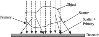 Figure showing Scatter radiation.