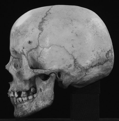 human-skull.tif