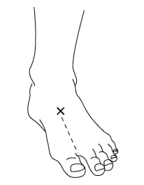 This image shows an x as the correct place to monitor a pulse in the adult foot. 