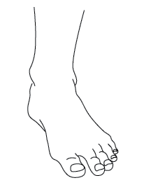 This is an image of an adult foot and ankle. 