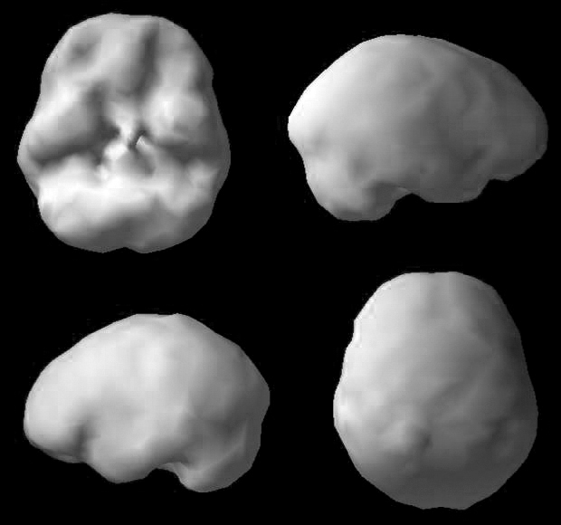 Surface SPECT scan showing uniform blood flow.