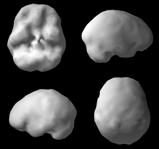 Surface SPECT scan showing uniform blood flow.