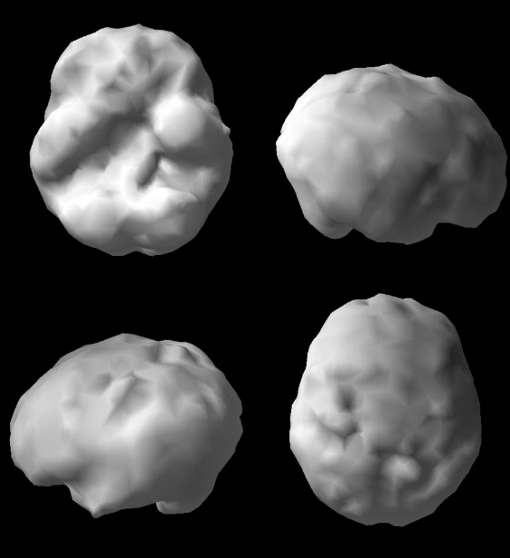 Surface SPECT scan showing uniform blood flow.