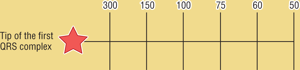 An illustration shows that the rates corresponding to the thick lines on ECG paper are 300, 150, 100, 75, 60, and 50.