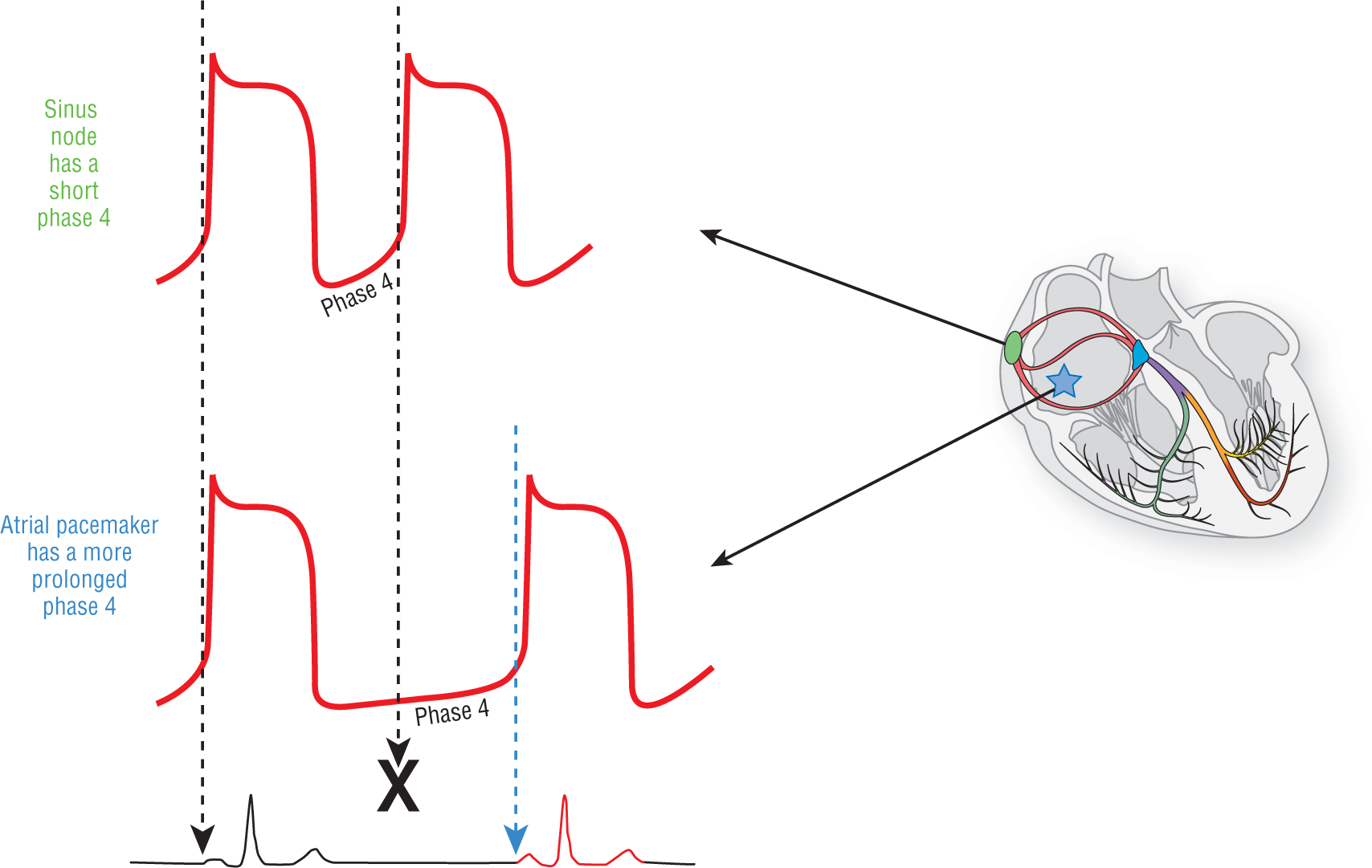 An illustration shows phase 4 of sinus node and atrial pacemaker.