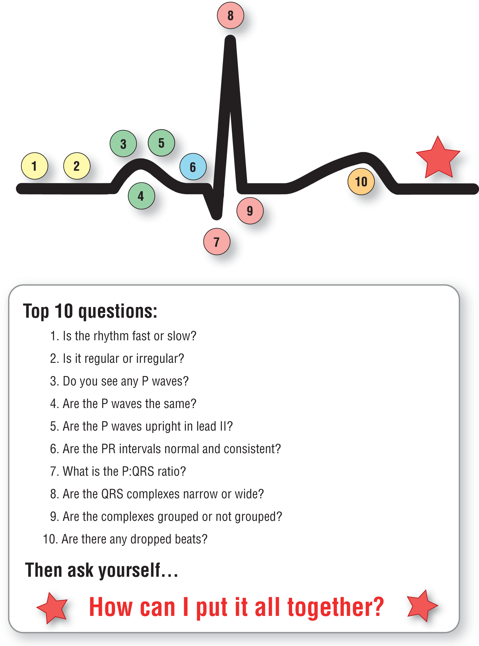 An illustration shows a normal ECG complex accompanied a list of questions to be asked while approaching a rhythm strip.