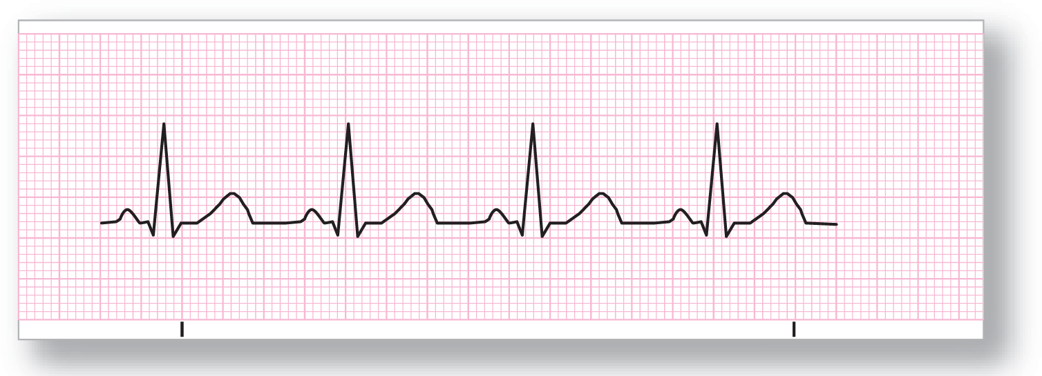 A rhythm strip shows a normal sinus rhythm with consistent intervals and normal rates.