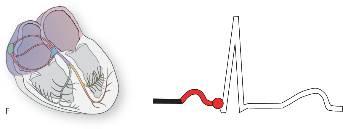 An illustration of the conduction system of the heart shows the atria highlighted. An ECG shows the pointer at the end of the PR interval.