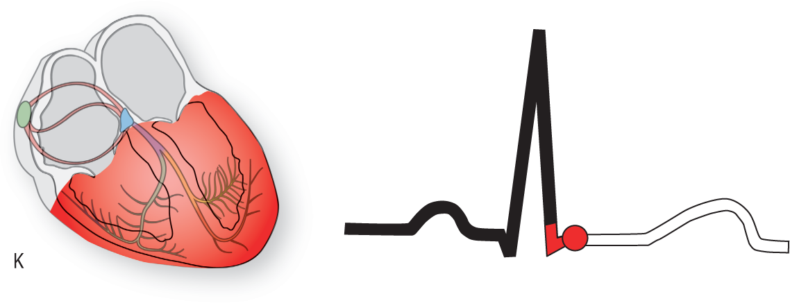 An illustration of the conduction system of the heart shows the ventricles highlighted. An ECG shows the pointer at the end of the S wave.