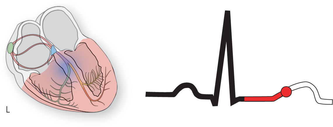 An illustration of the conduction system of the heart shows the ventricles highlighted. An ECG shows the pointer at the beginning of the T wave.