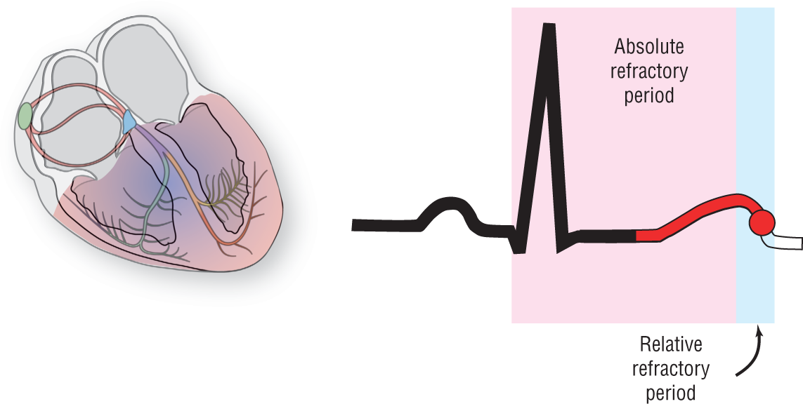 An illustration of the conduction system of the heart and an ECG represent the relative refractory period.