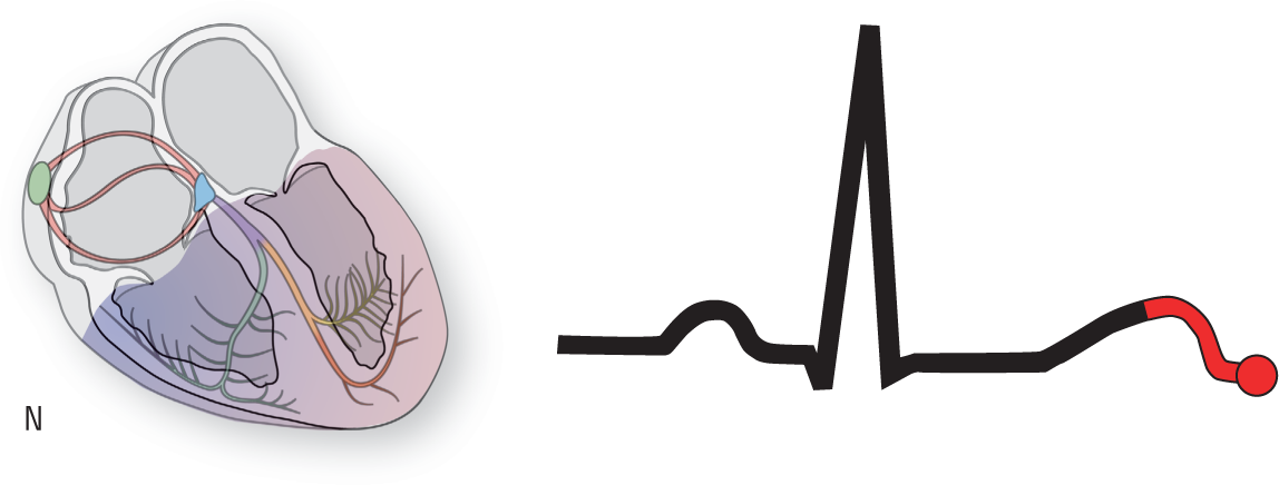 An illustration of the conduction system of the heart shows the ventricles highlighted. An ECG shows the pointer at the end of the T wave.