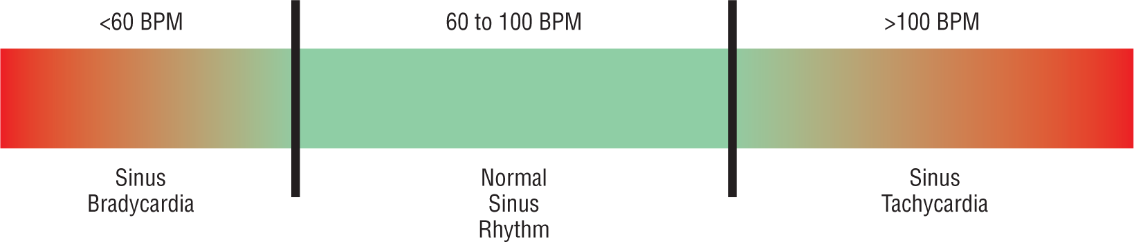 A spectrum shows the heart rate during different sinus rhythms.