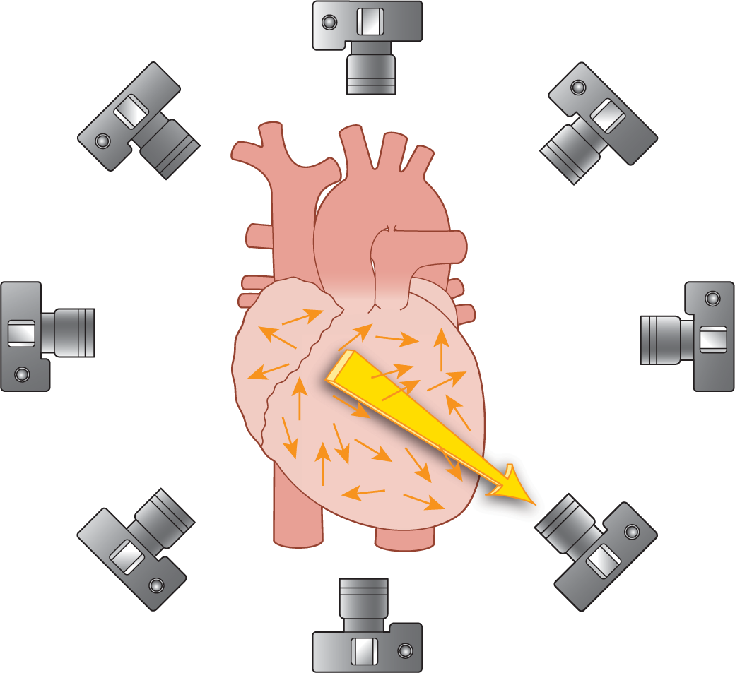 An illustration shows vectors pointing in different directions in the heart. The resultant vector points toward the left ventricle. Eight cameras surround the heart.