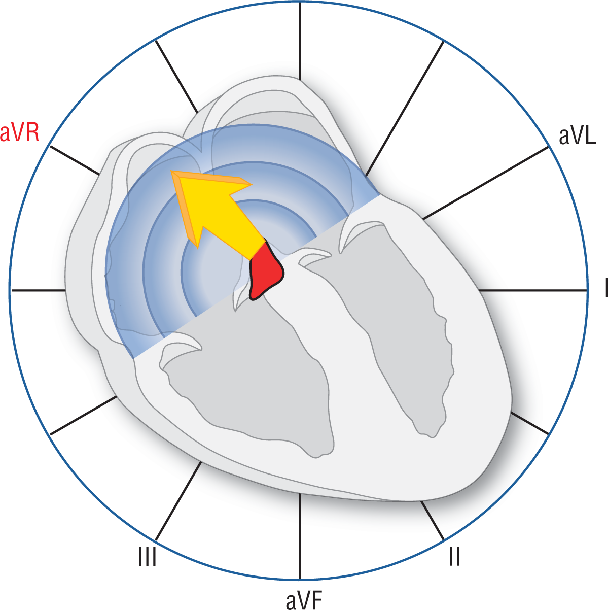 An illustration of heart shows a vector from the AV node pointing upward along the atrial septum. Concentric waveforms radiate from the node. Lead aVR is highlighted.