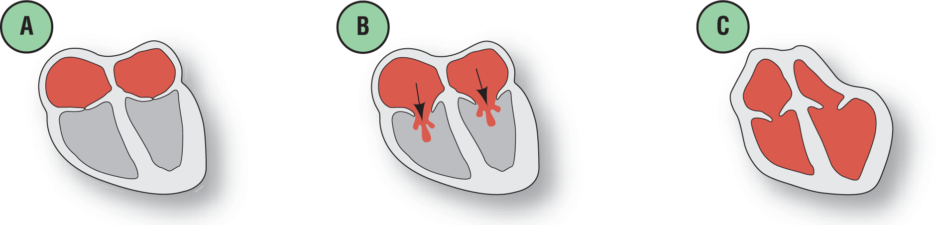 Three illustrations, A through C: A. The atria are filled; B. Blood flows from the atria into the ventricles; C. The atria are contracted and the ventricles are expanded and filled.