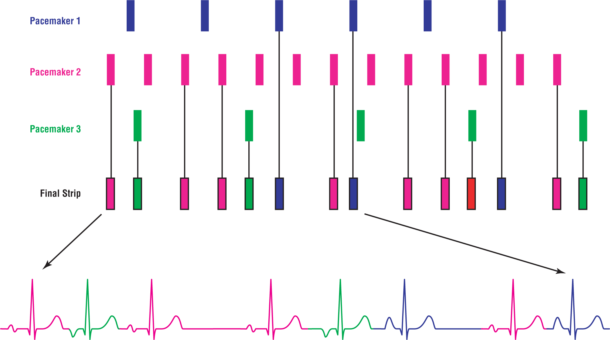 An illustration shows the pattern in the final rhythm strip generated by the combination of rhythm strips of pacemakers 1, 2, and 3.