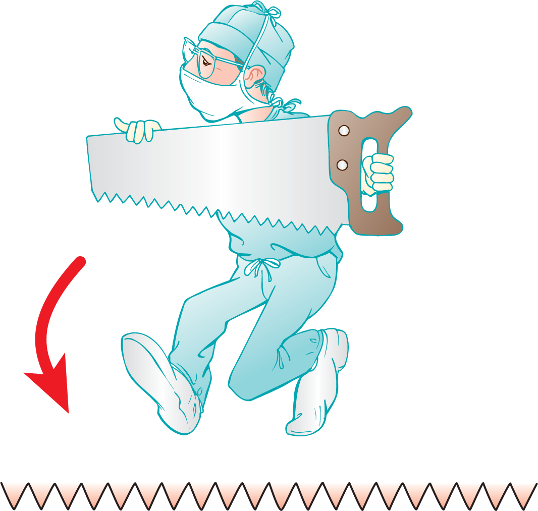 An illustration shows a surgeon carrying a saw with jagged tooth. It is accompanied by a wave with sawtooth pattern.