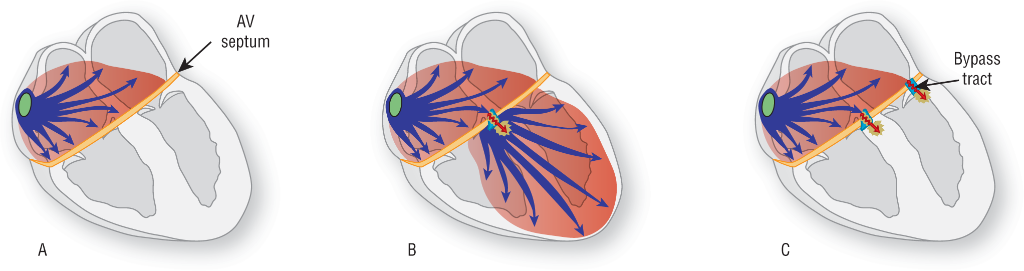 Three illustrations, A through C, show the transfer of pulses from the SA node.