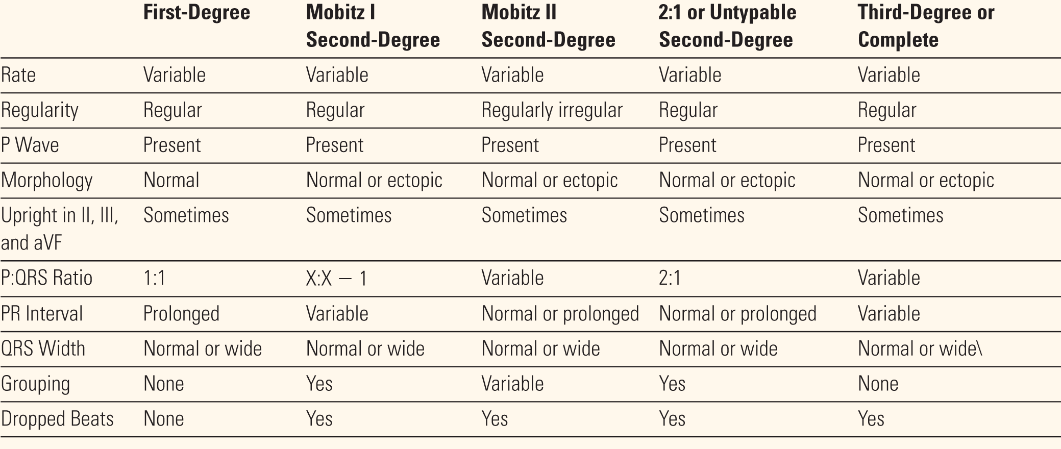 A table lists the characteristics of various atrioventricular blocks.