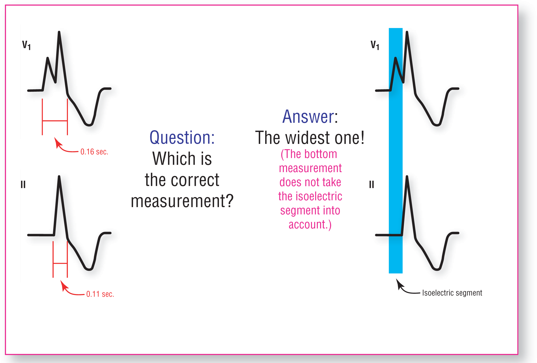 An illustration shows the correct measurement of QRS complexes at different leads.