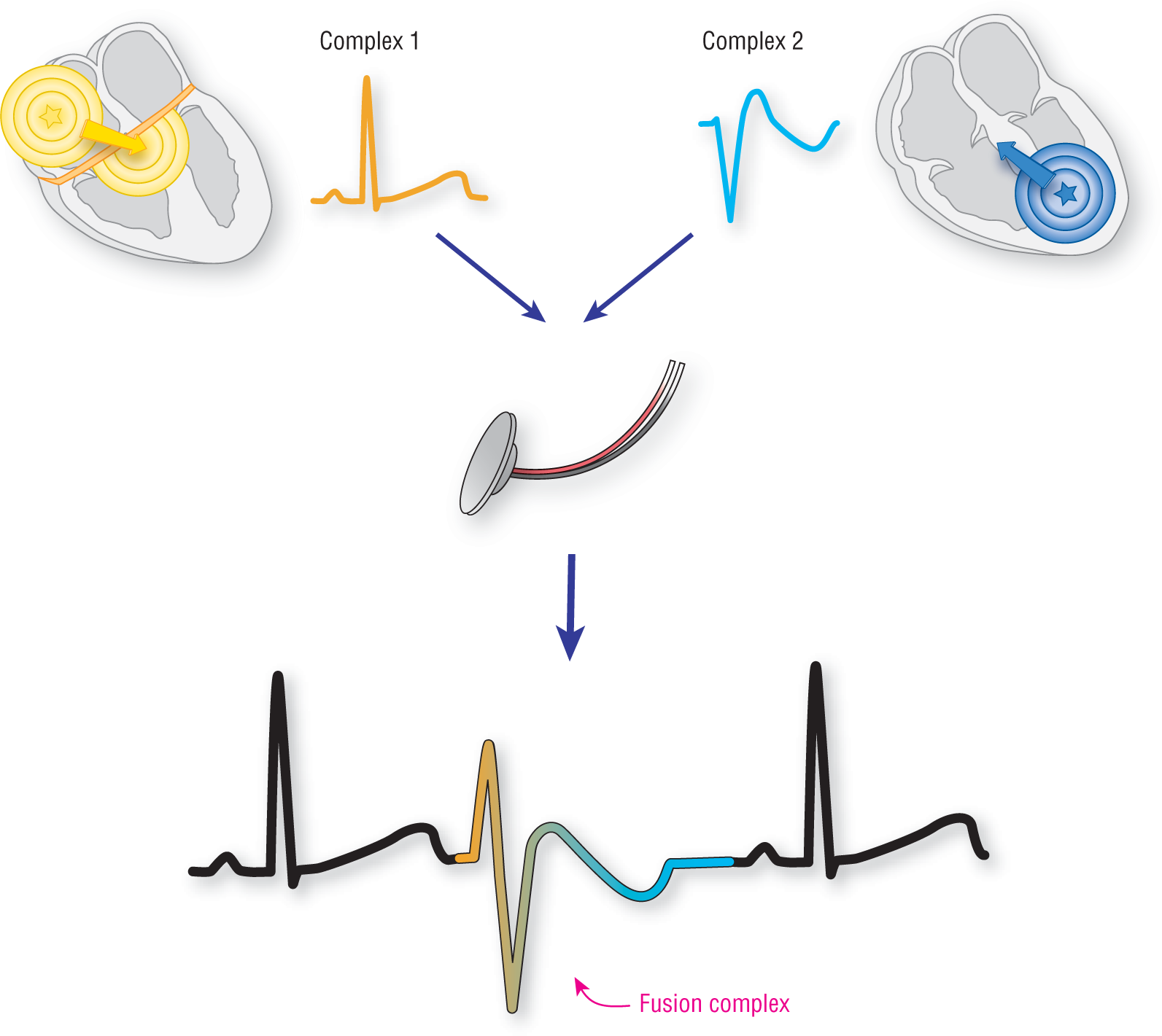 An illustration shows the formation of a fusion complex.