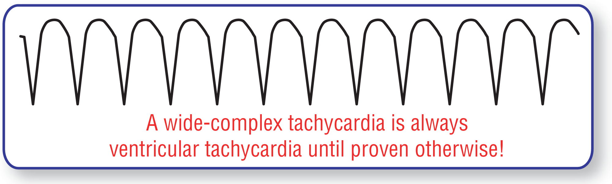 The ECG complex shows wide and curved peaks and sharp dips of high amplitude, occurring at high rate. Text reads, “A wide-complex tachycardia is always ventricular tachycardia until proven otherwise!”