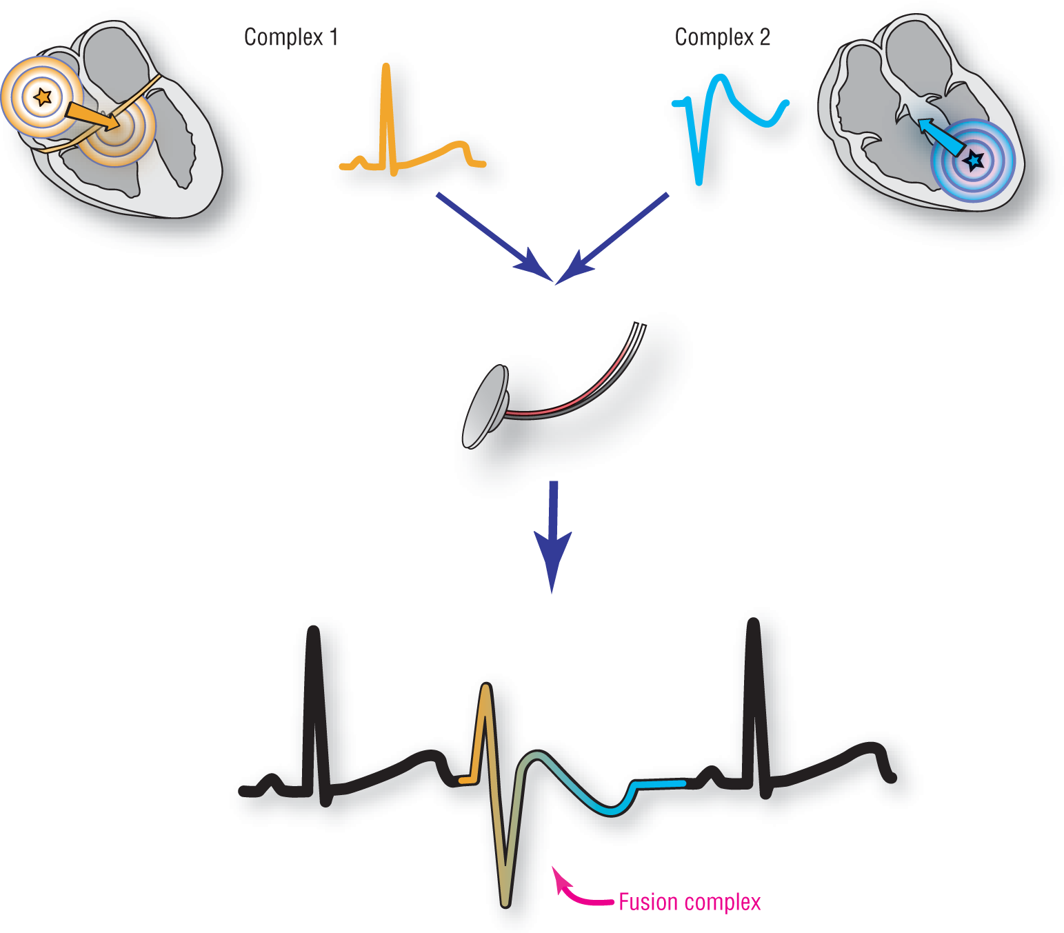 The illustration shows the formation of a fusion complex.