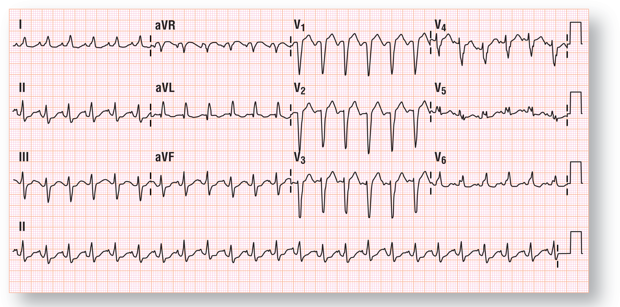 The rhythm strip shows ECG for case 3.