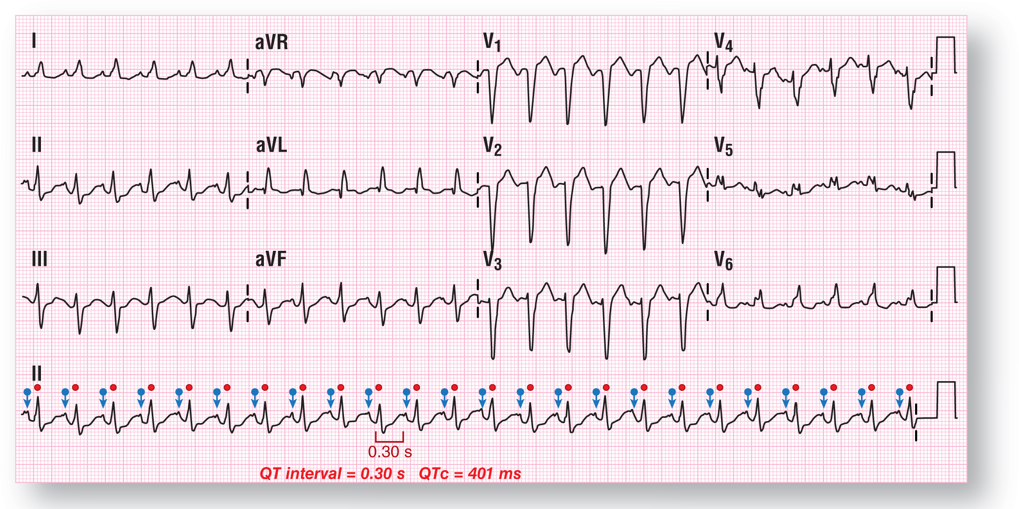 The rhythm strip shows ECG for case 3.