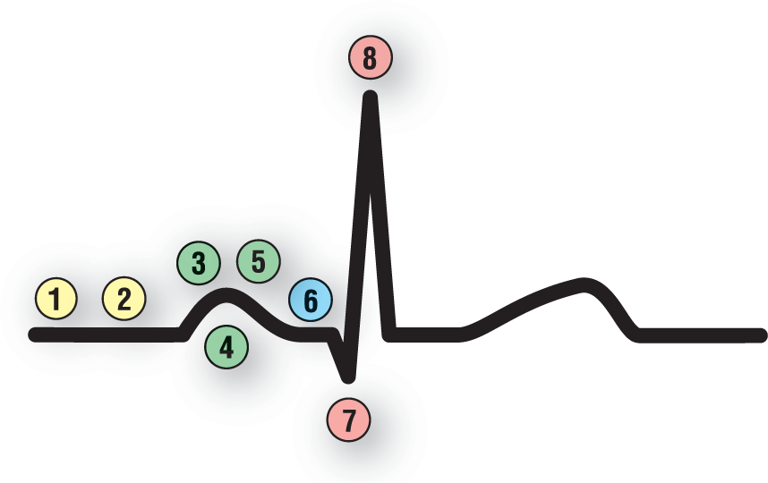 In a normal ECG complex, the beginning of the complex is labeled 1 and 2; the P wave is labeled 3, 4, and 5; the PR interval is labeled 6; the Q wave is labeled 7; and the R wave is labeled 8.