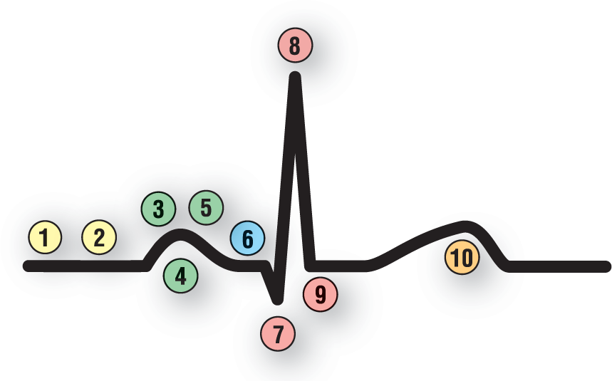 In a normal ECG complex, the beginning of the complex is labeled 1 and 2; the P wave is labeled 3, 4, and 5; the PR interval is labeled 6 and the QRS complex is labeled 7, 8, and 9; and the T wave is labeled 10.