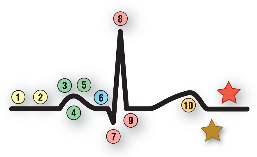 In a normal ECG complex, the beginning of the complex is labeled 1 and 2; the P wave is labeled 3, 4, and 5; the PR interval is labeled 6 and the QRS complex is labeled 7, 8, and 9; the T wave is labeled 10; and the end of the complex is labeled with two stars.