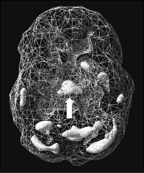 pg141_limbicsystem_rep.tif