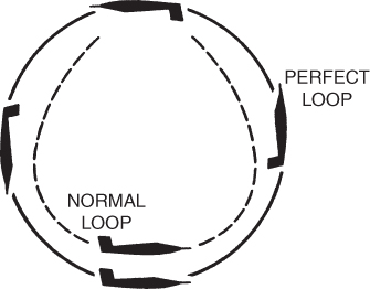 A schematic diagram for perfect and normal loop.