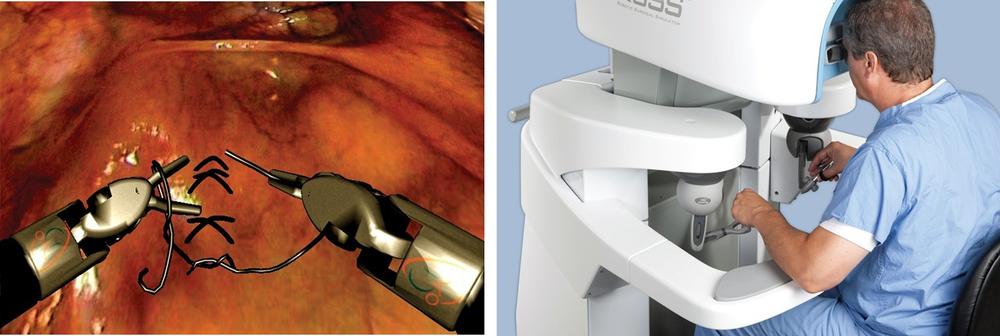 Surgical simulators are used to train surgeons in minimally invasive techniques, courtesy of Simulated Surgical Systems