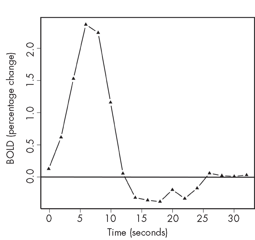 FIGURE 7–4. Relative blood oxygenation level–dependent (BOLD) response to 1-second visual stimulation.