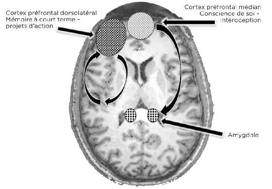  Contrairement au cortex préfrontal médian – le siège de la conscience de soi –, la partie rationnelle, analytique du cerveau, centrée sur le cortex préfrontal dorsolatéral, n’a pas de liens directs avec le cerveau émotionnel, où se trouvent la plupart des traces du traumatisme.