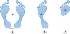 B9780702030321000019/gr21.jpg is missing