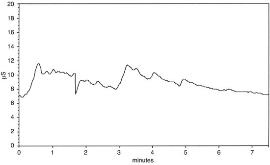 ch09fig004.eps