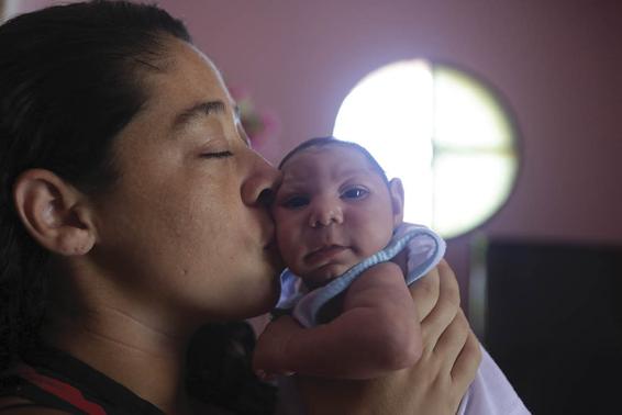 Photo of a mother kissing the small head of a baby with microcephaly.