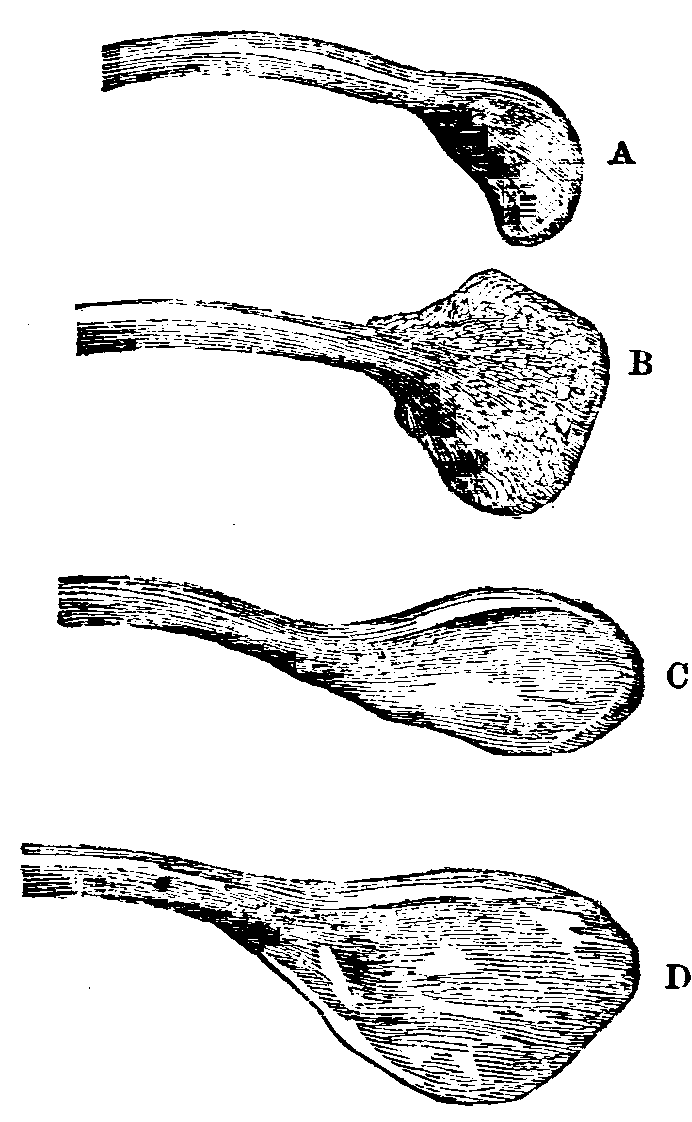 Fig. 38.--Extremities of the Furculæ of Fowls.