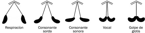 5.9 Estados de la glotis: el efecto de abrirse o cerrarse las cuerdas vocales. La estructura gris representa el cartílago tiroides que está en una posición anterior. Las estructuras negras representan los cartílagos aritenoides que están en una posición posterior. Las líneas representan las cuerdas vocales.