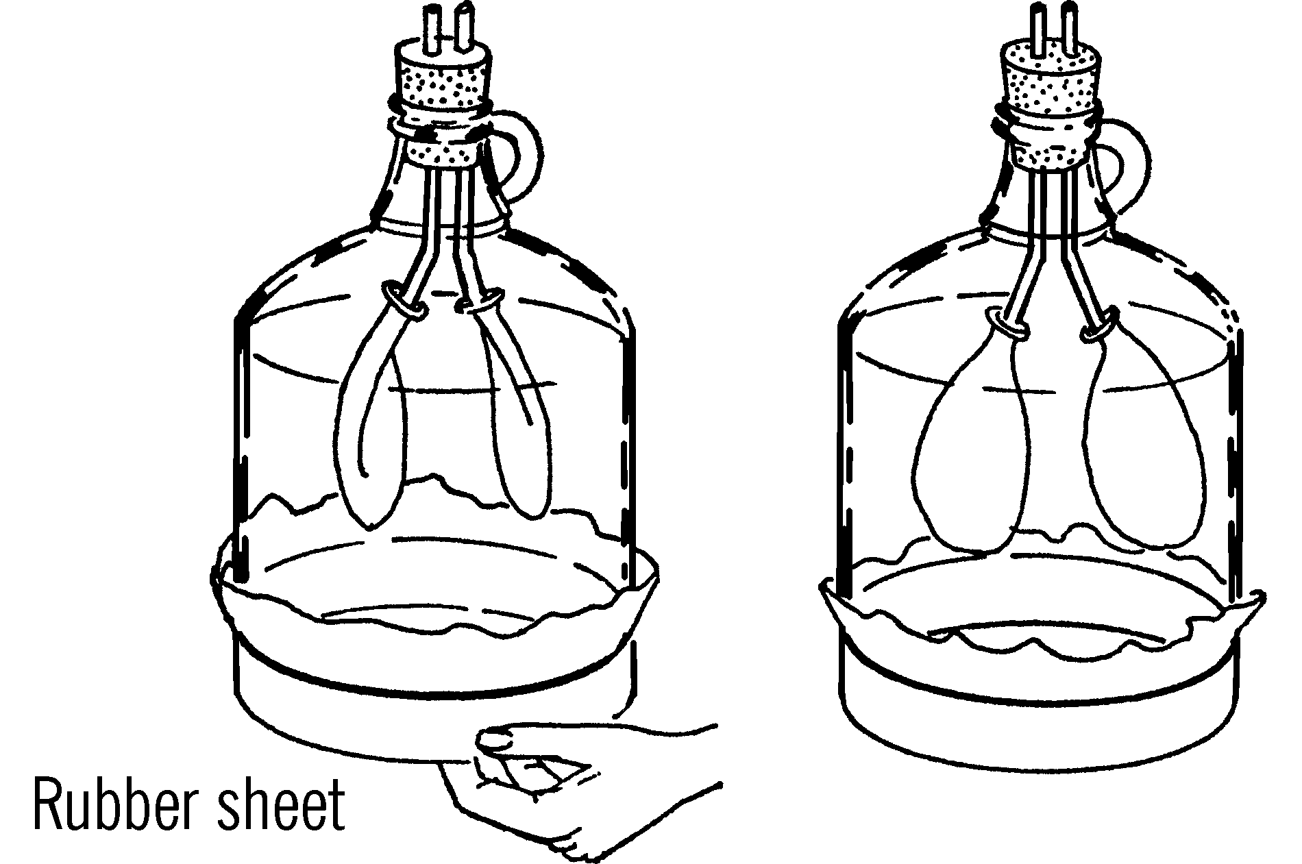 Chest cavity.