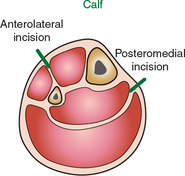 fig