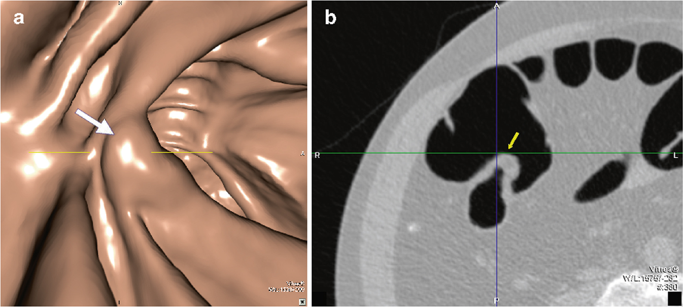 A978-3-540-79886-6_10_Fig29_HTML.jpg