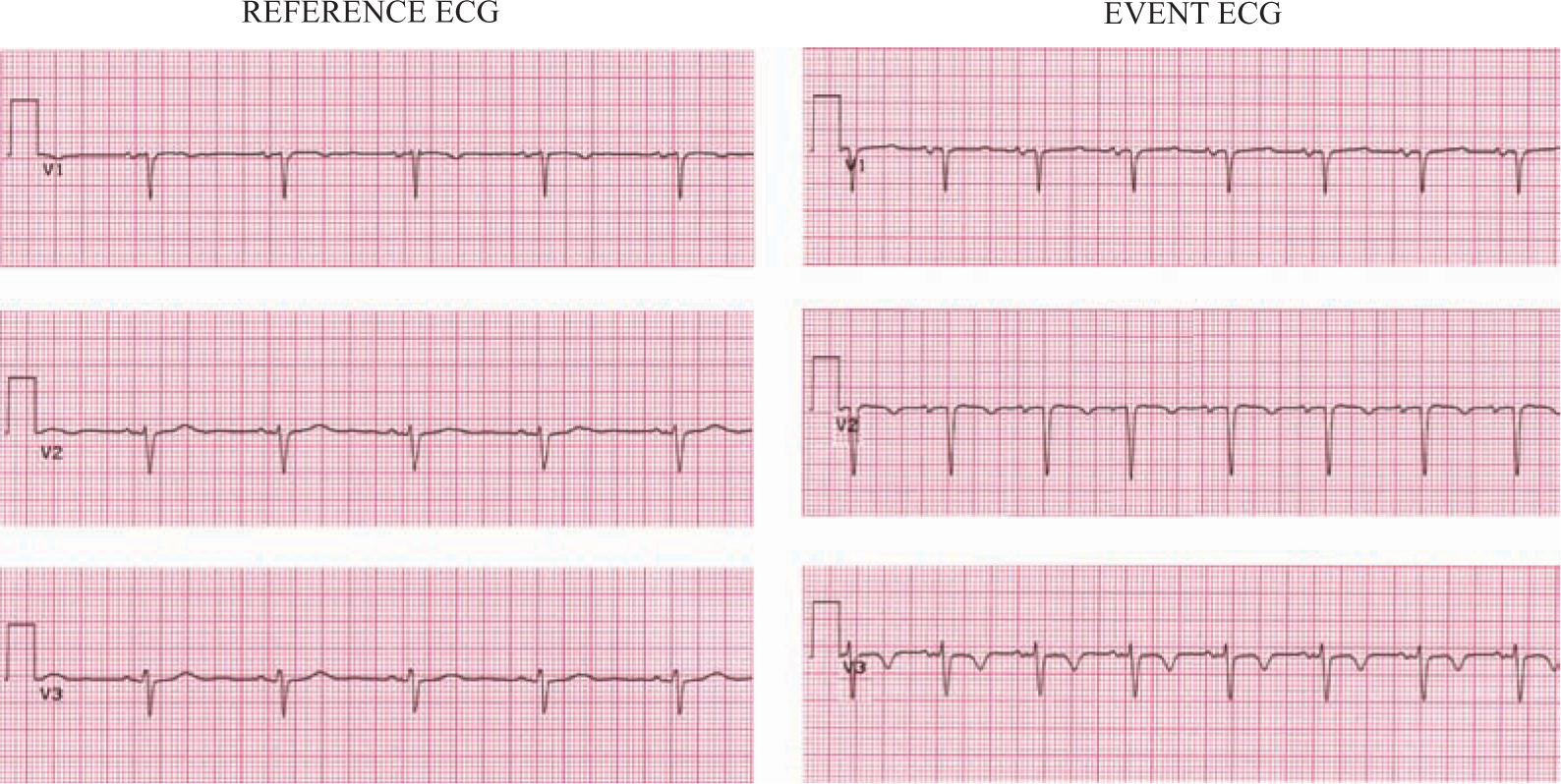 A978-1-84882-778-3_15_Fig29_HTML.jpg