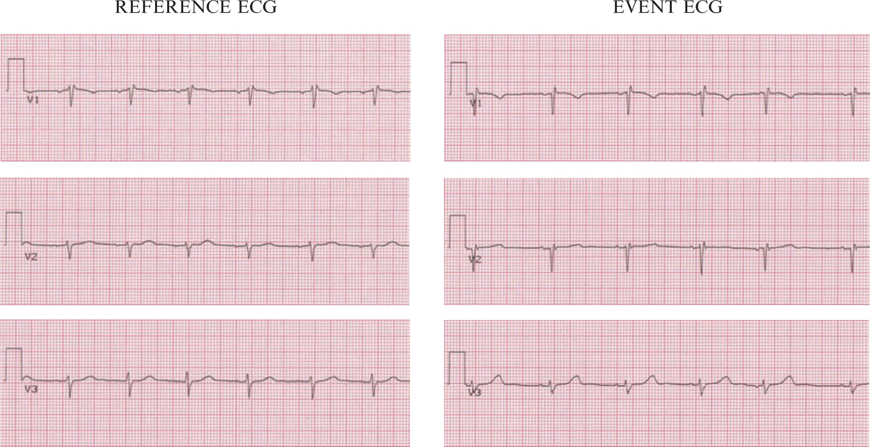 A978-1-84882-778-3_15_Fig2_HTML.jpg